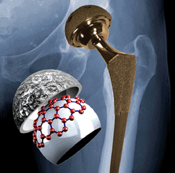 Image: Schematic illustration of graphitic material on the surface of the implant; the red spheres represent the positions of the carbon atoms in a single layer of graphite. (Photo courtesy of Northwestern University). Image: Schematic illustration of graphitic material on the surface of the implant; the red spheres represent the positions of the carbon atoms in a single layer of graphite. (Photo courtesy of Northwestern University).